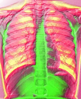 Medical Computer Graphics Prints: A normal chest X-ray