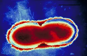 Electron Microscopy Images Prints: Pseudomonas cepacea